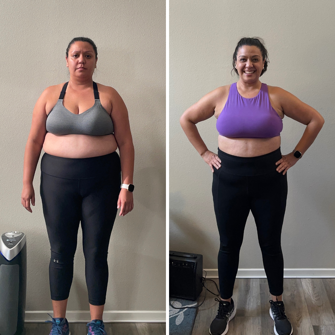 Letty L. before and after