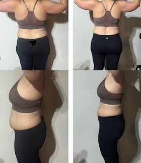 Catherine L. before and after